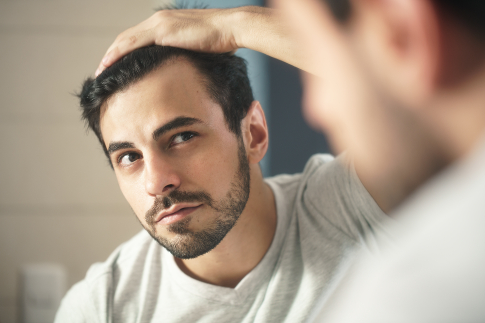 what is alopecia?