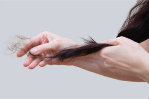 age for worrying hair loss