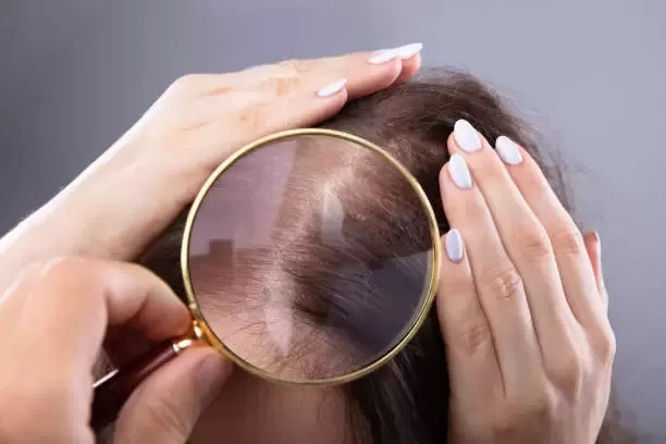 women hair transplant in mexico