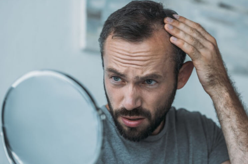 Male Psyche and Facial Hair Loss