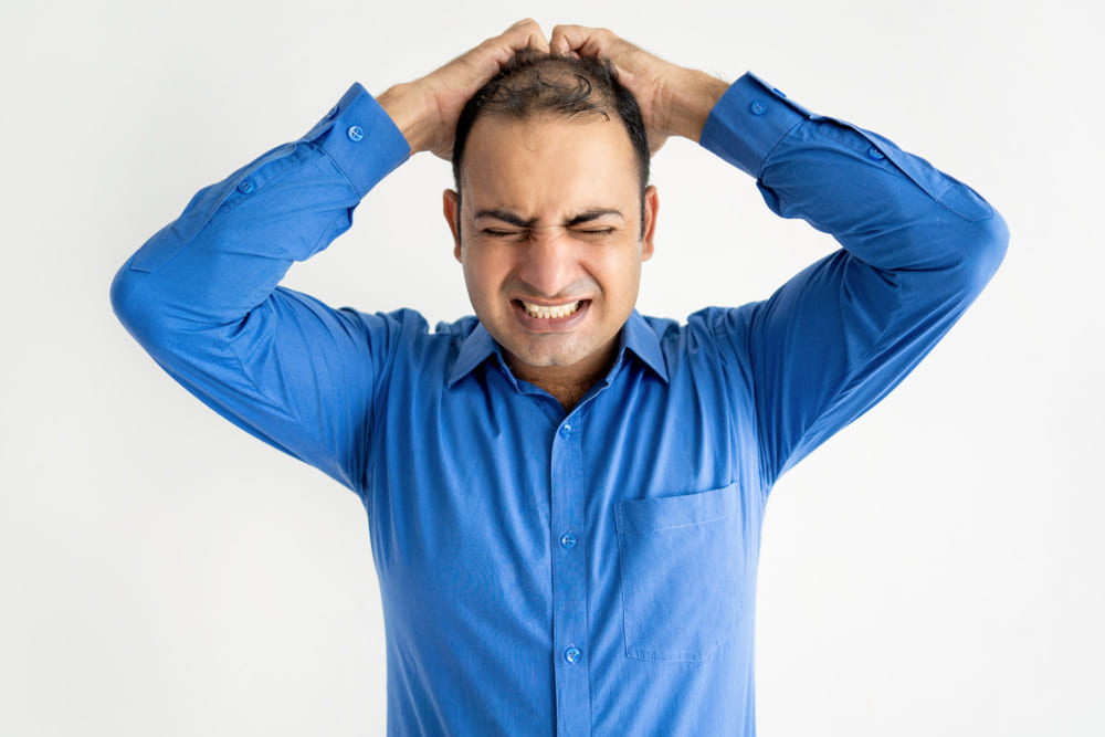 Telogen Effluvium hair loss due to stress