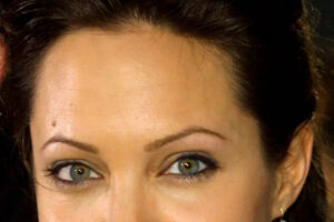 Eyebrow grafting is in fashion among celebrities