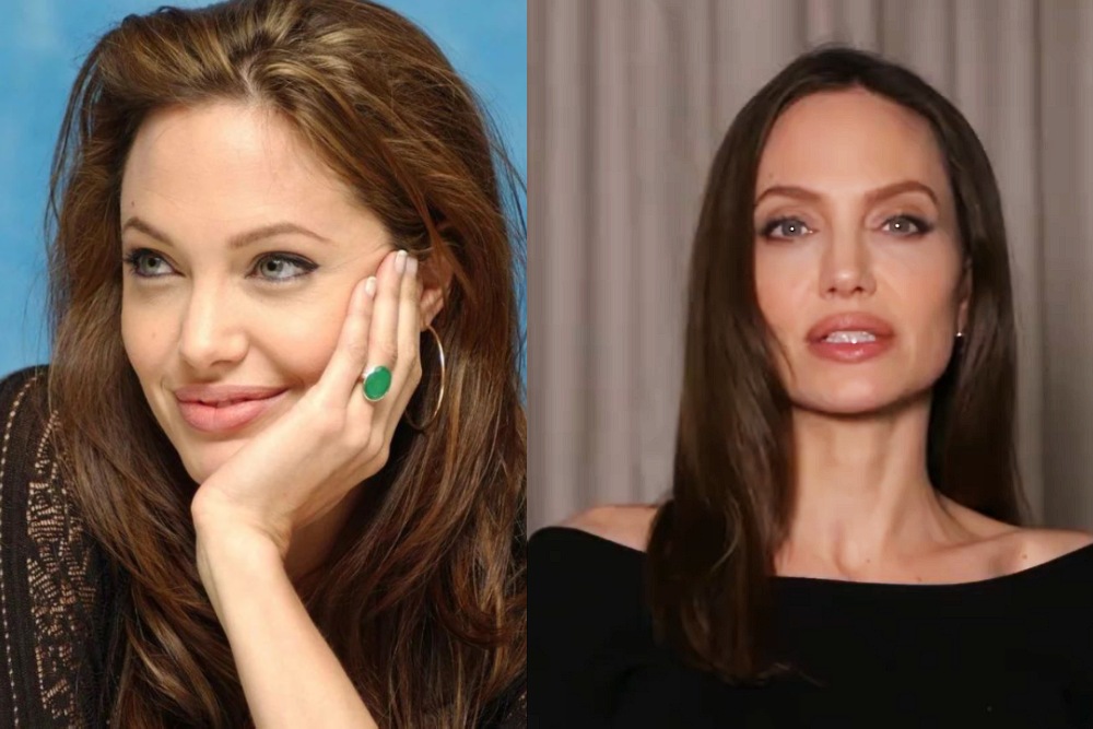 Injerto de cejas antes y después de Angelina Jolie