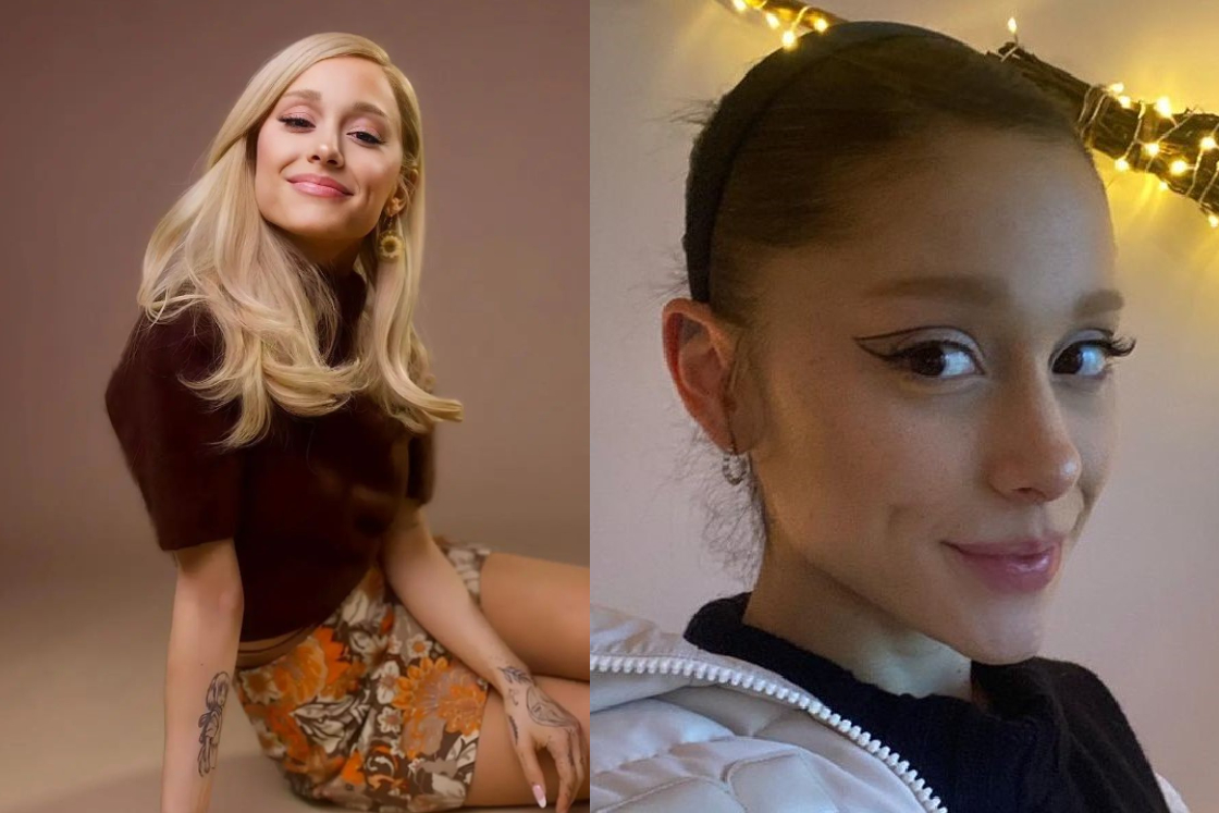 Ariana Grande and hair grafts on female celebrities