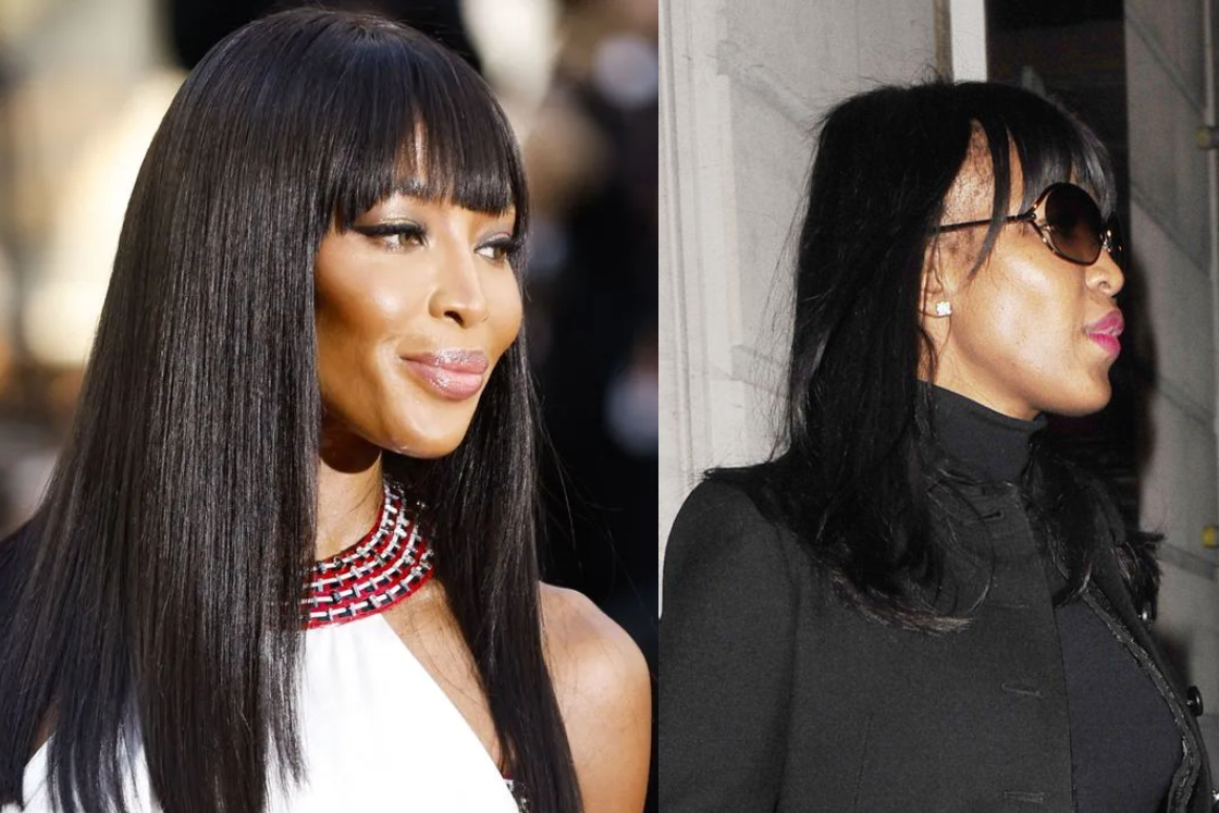 Naomi Campbell y el trasplante de cabello para mujeres