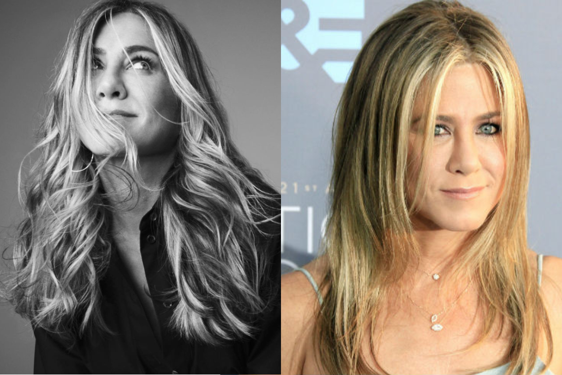 Injerto capilar mujeres famosas como Jennifer Aniston