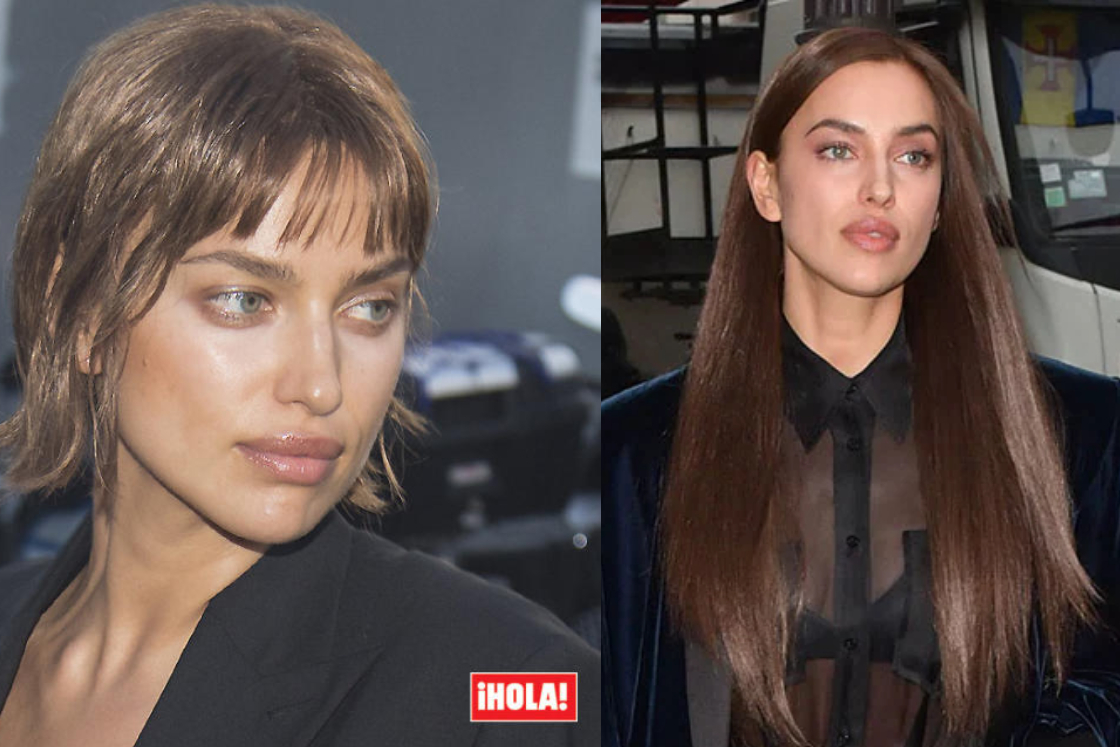 Injertos de cabello en celebridades femeninas, como irina Shayk