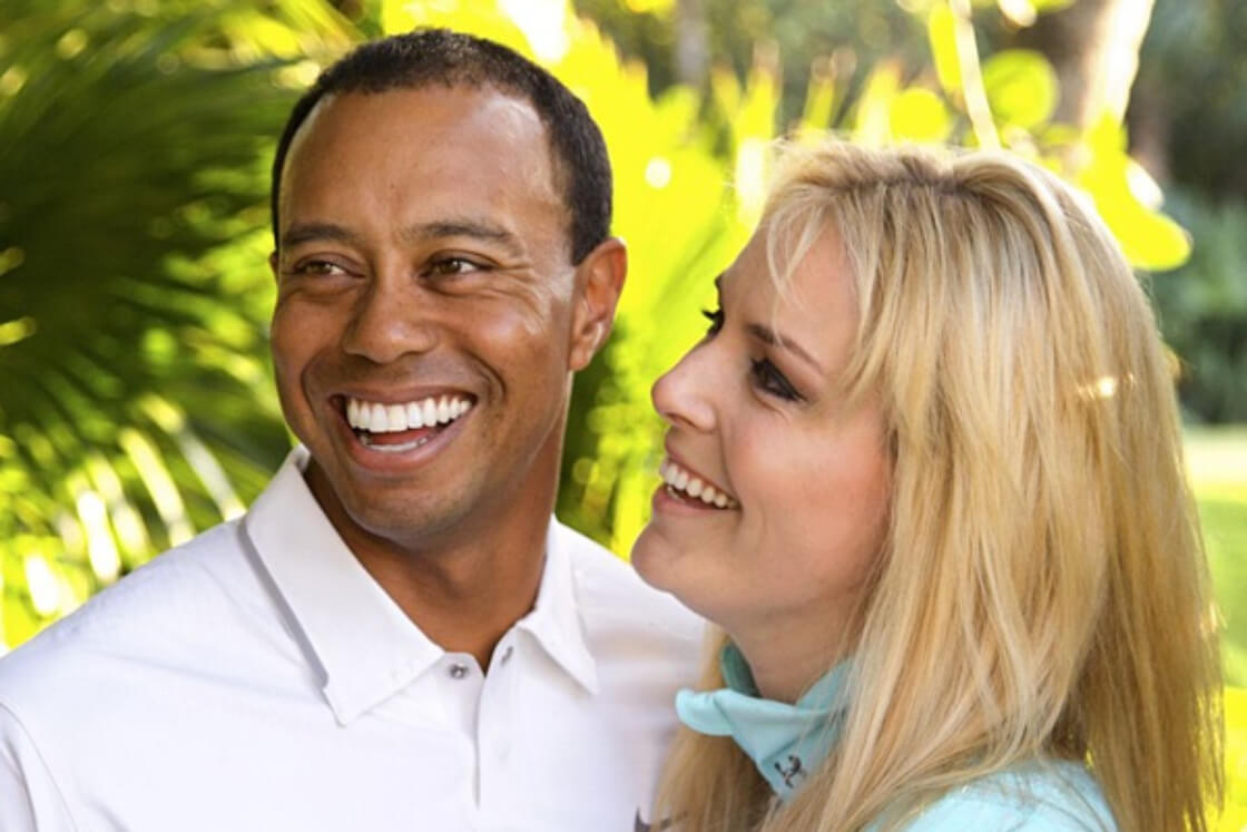 Tiger Woods perdida de cabello