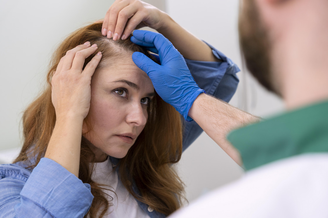 Tratamientos para la caída de cabello