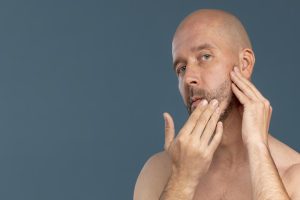 Barba irregular: causas y cómo tratarla