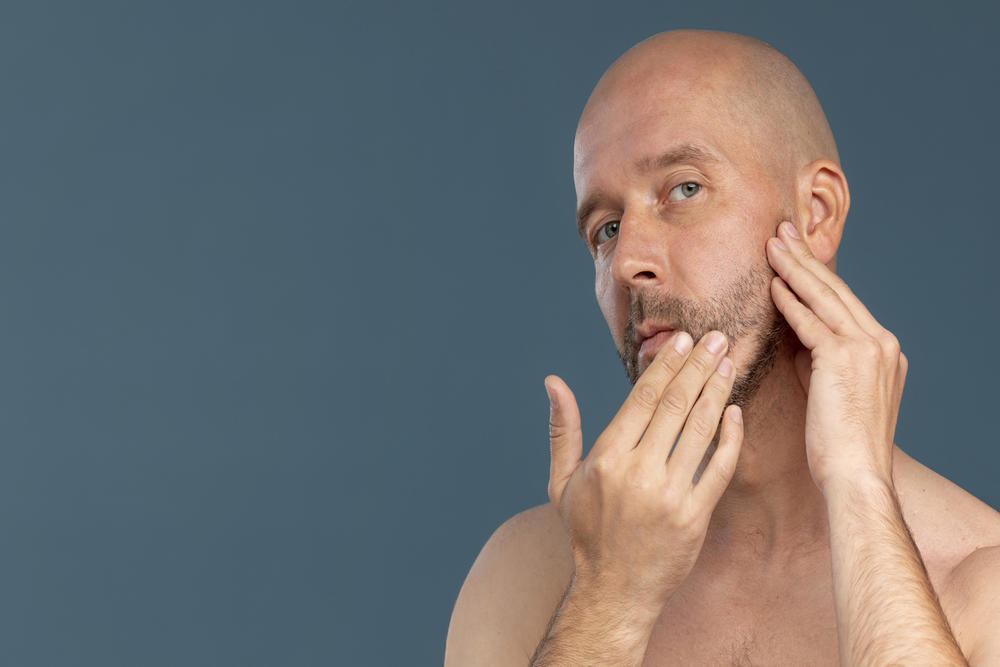 Barba irregular: causas y cómo tratarla