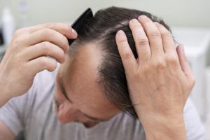 Consejos para prevenir la caída del cabello