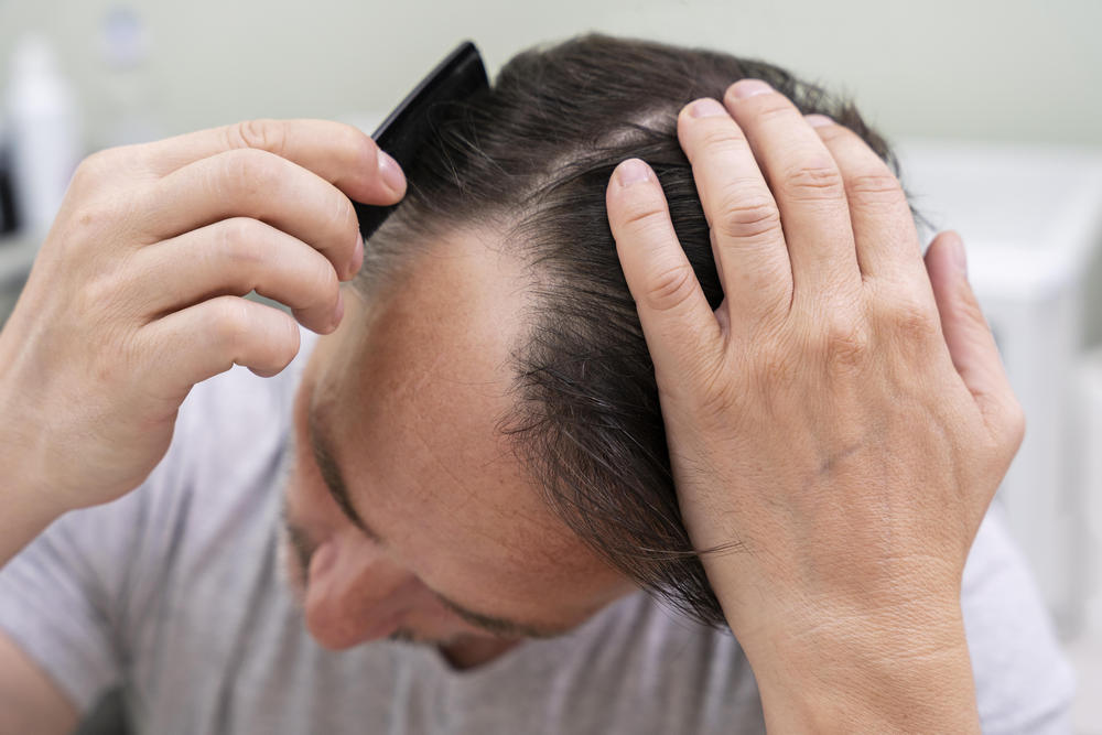 Tips to prevent hair loss
