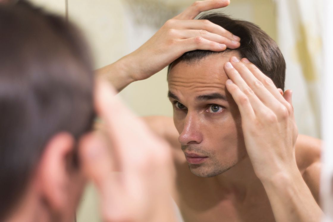 Male and Female Patterns in Hair Loss