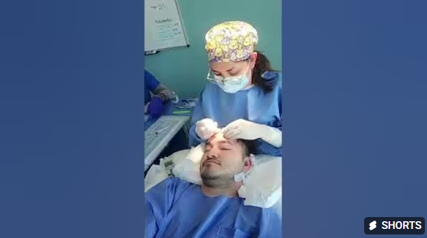 Erik’s Hair Transformation at Hairfix