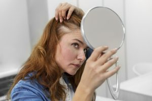 Escala de ludwig y la alopecia femenina