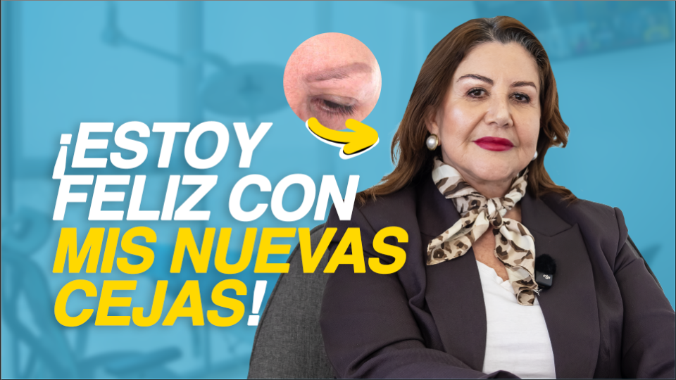 Un año después de mi injerto de cejas | Hairfix