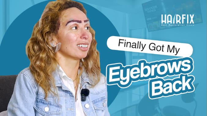 Finally Got My Eyebrows Back l Hairfix Mexico