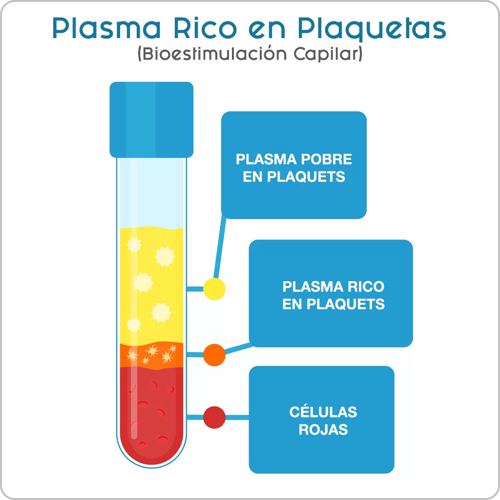 PRP-plasma-rico-en-plaquetas-bioestimulacion-capilar-tijuana-mexico-cdmx-clinica-cabello