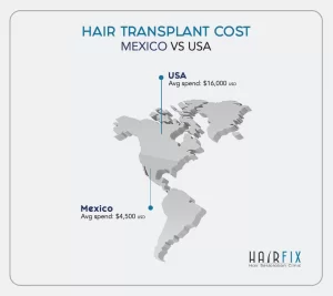 hair_transplant_cost_price_tijuana_mexico_usa_hair_implant