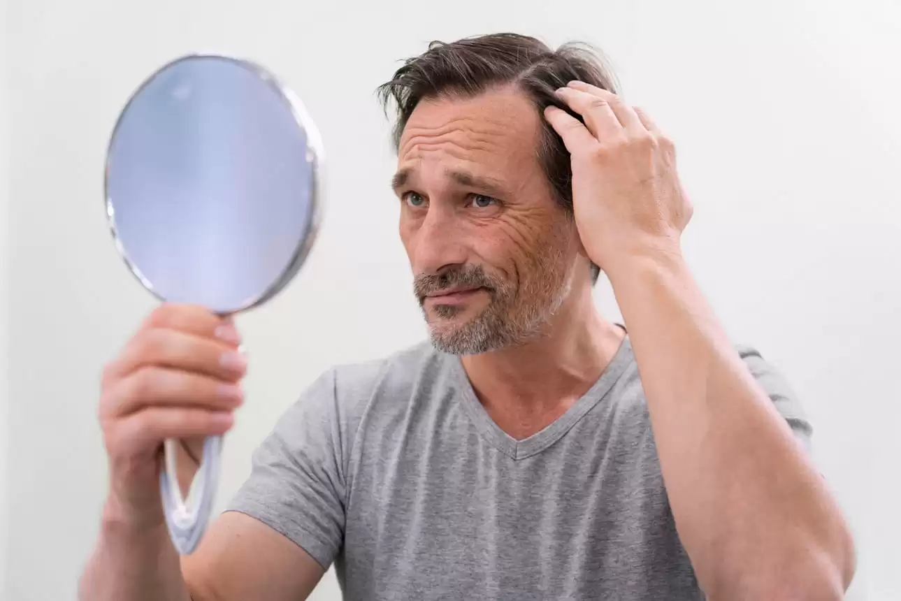 Hair loss treatment for men