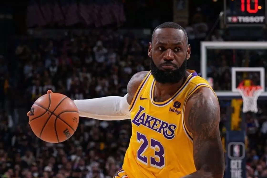 Lebron James pattern of alopecia