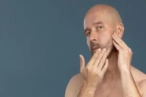 Barba irregular: causas y cómo tratarla